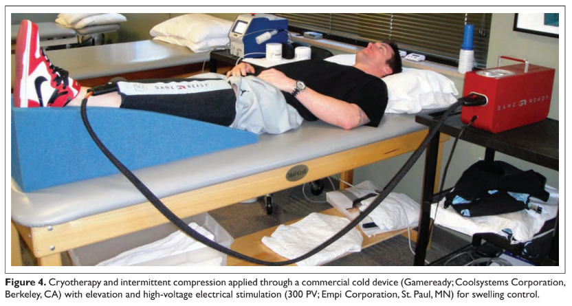 Cryotherapy and intermittent compression applied through a commercial cold device